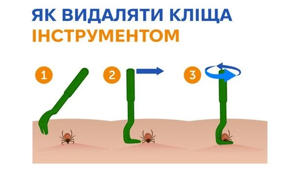 Кліщ уже присмоктався, а медичного закладу поблизу немає: як впоратися з цим самостійно та що суворо заборонено робити 3 Видалення кліща спеціальним інструментом / © Центр громадського здоров’я МОЗ України