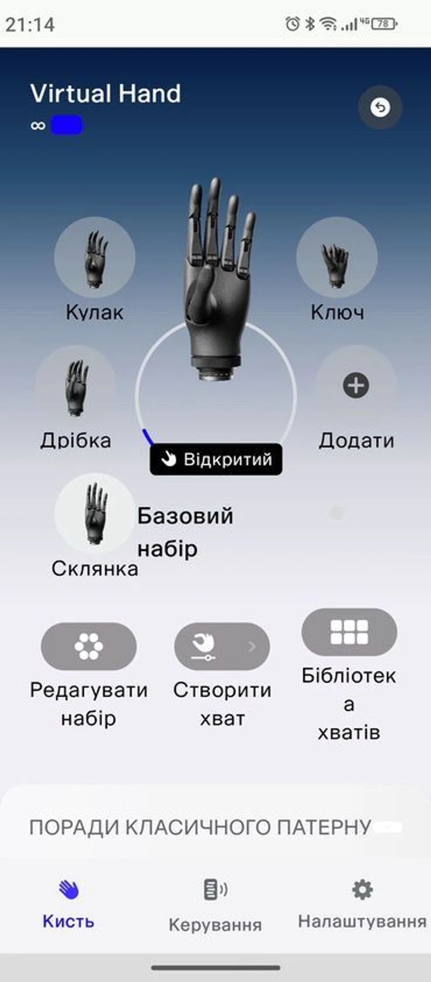 Екскурсія на виробництво Esper Bionics: як створюють біонічні протези в Україні 62