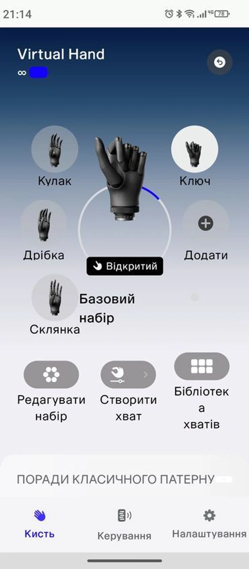 Екскурсія на виробництво Esper Bionics: як створюють біонічні протези в Україні 63