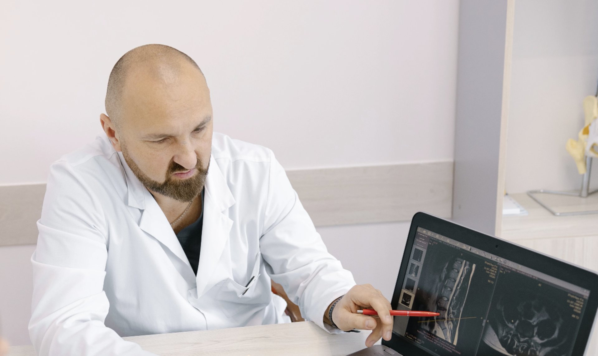 Ботулінотерапія від хронічного головного болю: коли варто вдатися до процедури 5