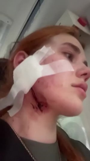 Напад на українців у Польщі: затримано двох підозрюваних