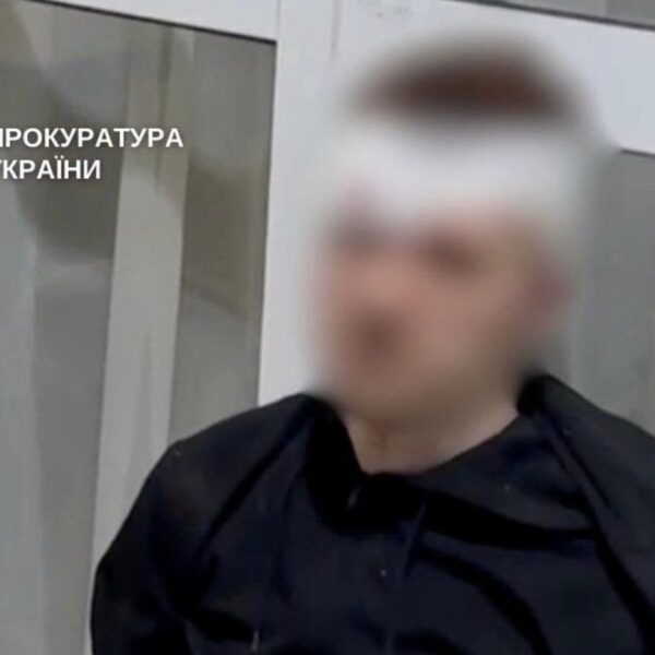 Крута ідея для вечері: курячі стегенця в медово-гірчичному соусі. Це геніально!