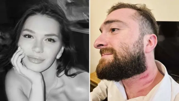 Туристку, яка розмовляла російською, вдарили в Грузії: свідки розповіли про справжню причину суперечки в готелі.