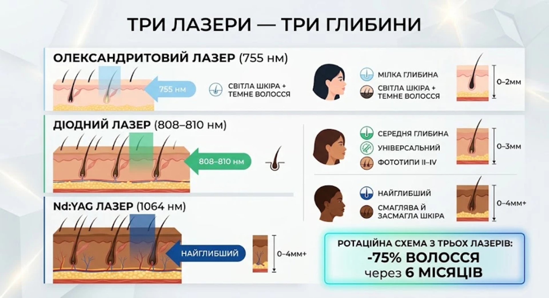Нові дослідження: як лазерна епіляція стає точнішою завдяки італійським дерматологам 5