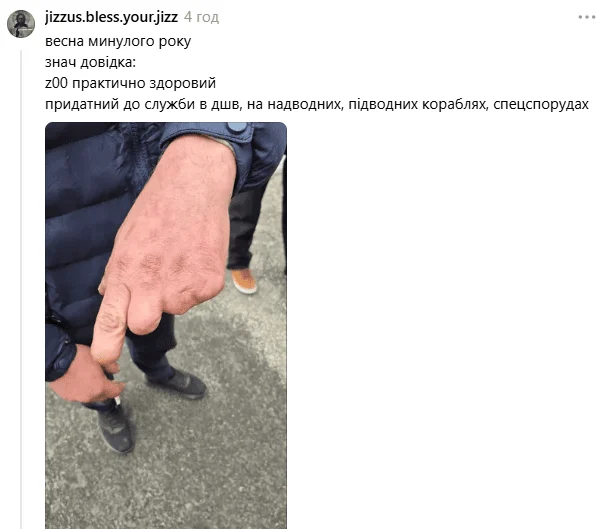 Військово-лікарська комісія на Харківщині визнала чоловіка, який втратив три пальці на руці, придатним до військової служби, як повідомляють соціальні мережі. 12