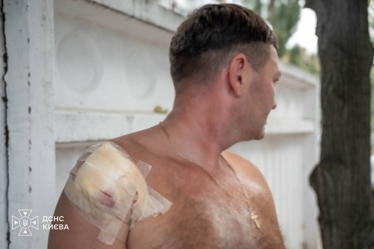 Ворог продовжує завдавати ударів по Києву: під час одного з влучань у кав'ярню отримав поранення чоловік. 11