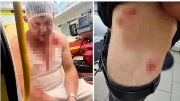 Трьох громадян України жорстоко побили у Польщі через музичні вподобання. Правоохоронці оприлюднили подробиці інциденту.